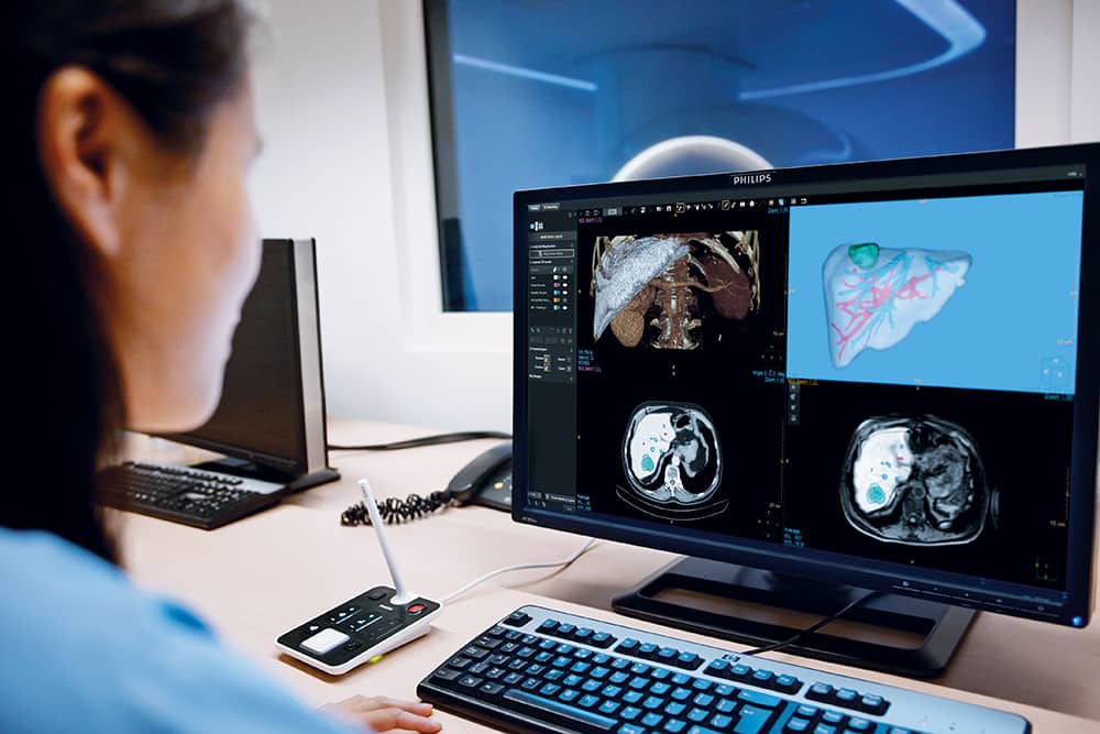 Das IntelliSpace Portal fördert eine höhere Diagnosesicherheit.